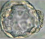 Blastocyst with very clear Inner Cell Mass